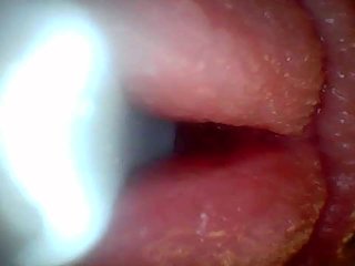 Endoscope camera shows the most sensitive parts of the penis Educational video